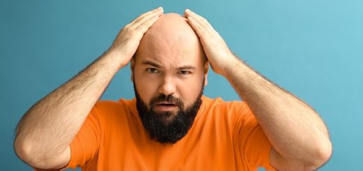 5 Causes Of Baldness In Males 2