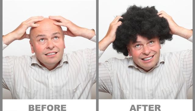 8 Causes Of Hair Loss 6