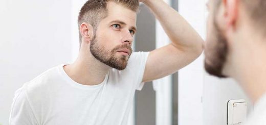 Baldness Is These 3 Points! Do These Things To Belp You Prevent 1
