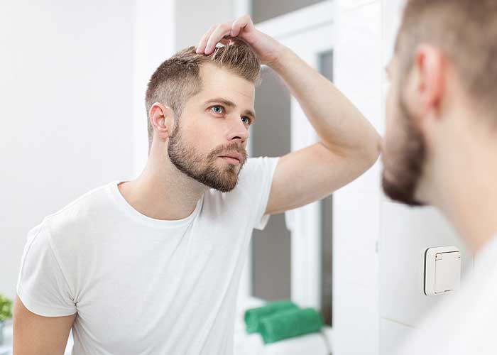 Baldness Is These 3 Points! Do These Things To Belp You Prevent 1