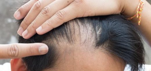 Frequent Hair Loss May Be Caused By 6 Diseases 2