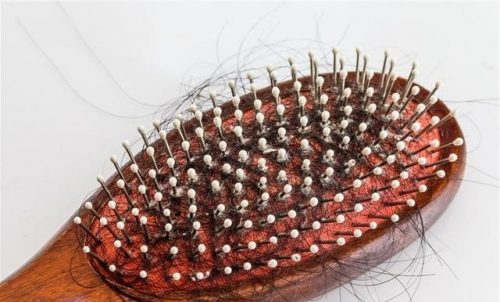 Frequent Hair Loss May Be Caused By 6 Diseases 3
