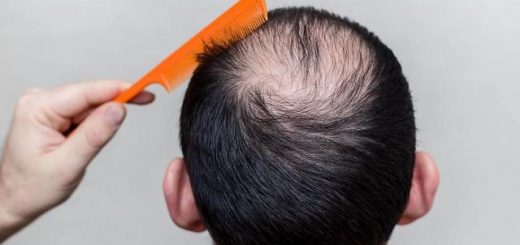Frequent Hair Loss You May Lack 6 Nutrition 2