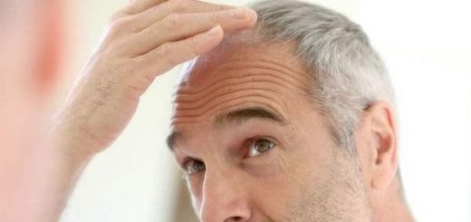 Increased Hair Loss And White Hair May Be Due To Lack Of These 3 Nutrients 1
