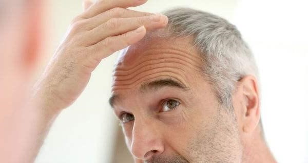 Increased Hair Loss And White Hair May Be Due To Lack Of These 3 Nutrients 1