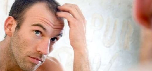 Watch Out For Baldness In Men 3 Points To Treat Hair Loss Are Important 3