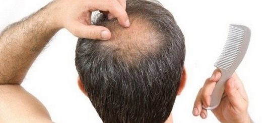 Why Do Men Lose Their Hair Easily In Middle Age2